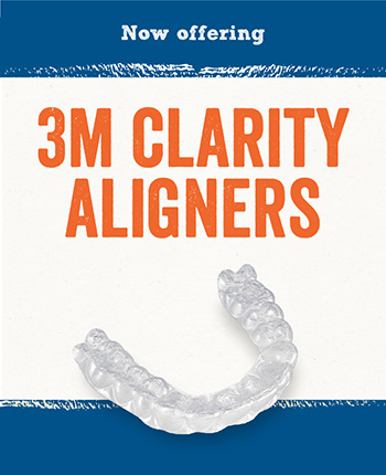 3M Clarity Aligners